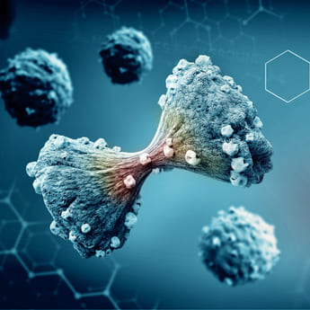 Patient Flow Analysis For A Global Oncology Leader